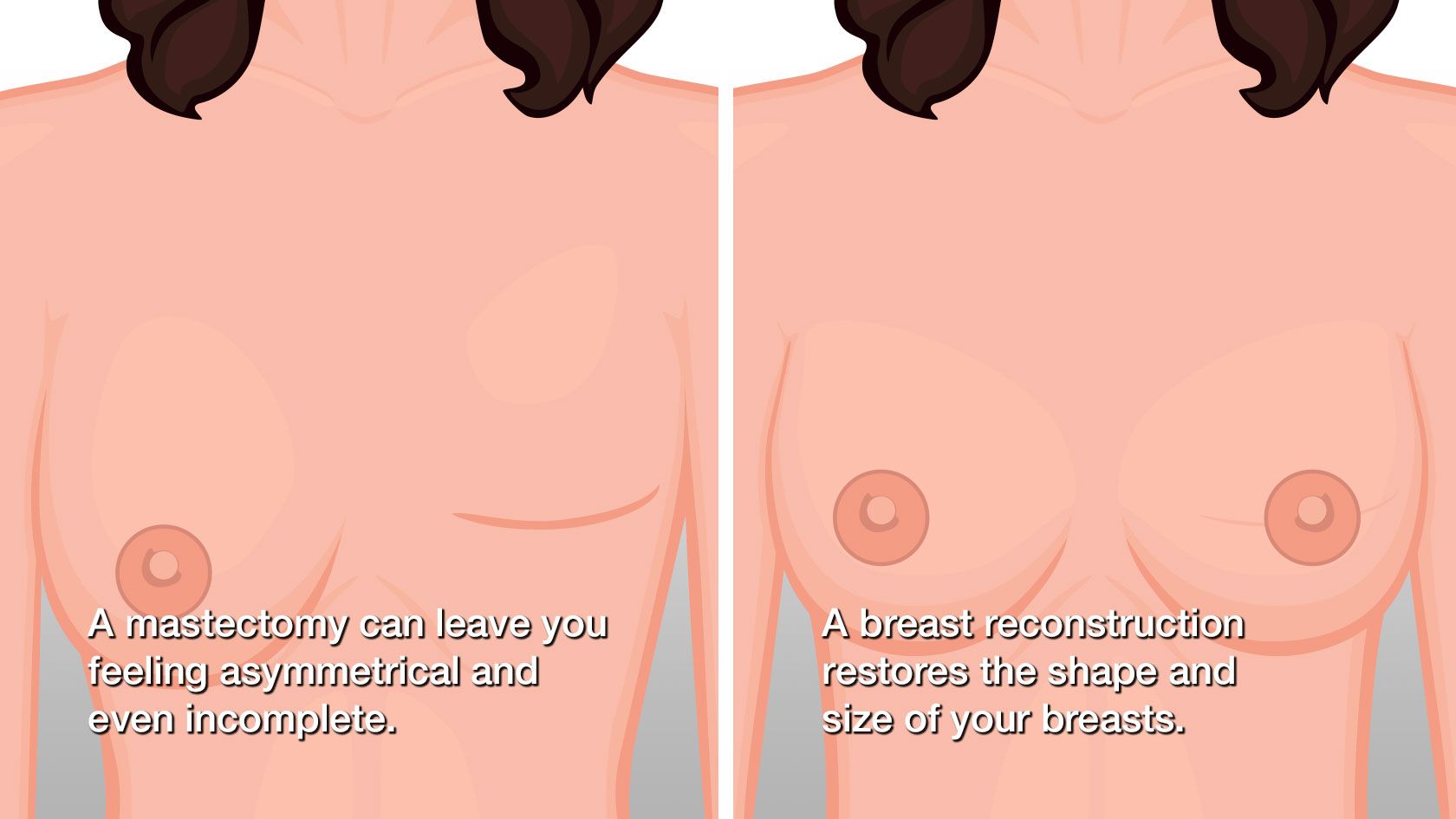 before and after a breast reconstruction
